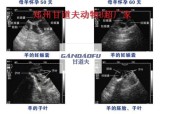 羊超声波早期技术研究，提高羊育种效率的重要手段