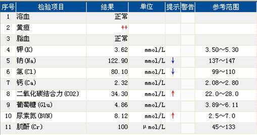 NA历史上最低得纪录是多少？NA最低比是多少？  第1张